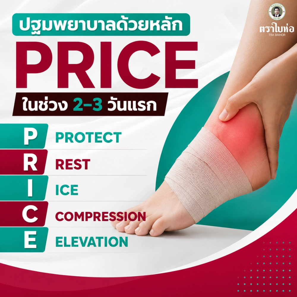 ปฐมพยาบาลด้วยหลัก PRICE ในช่วง 2–3 วันแรก