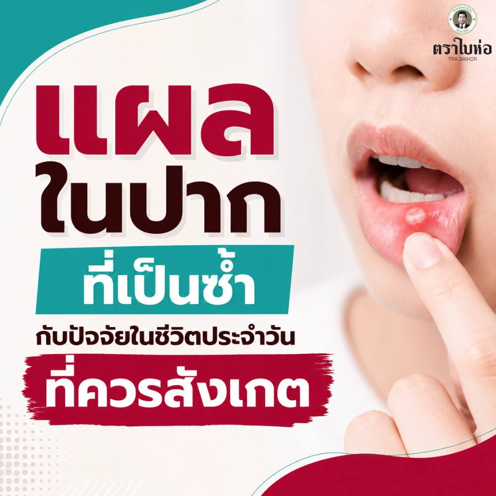 แผลในปาก ที่เป็นซ้ำกับปัจจัยในชีวิตประจำวันที่ควรสังเกต
