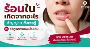 ร้อนในเกิดจากอะไร สัญญาณที่ควรรู้และวิธีดูแลตัวเองเบื้องต้น