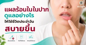 แผลร้อนในในปากดูแลอย่างไรให้ใช้ชีวิตประจำวันสบายขึ้น