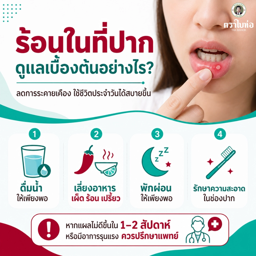 วิธีดูแล แผลร้อนใน ให้ใช้ชีวิตประจำวันสบายขึ้น